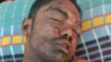 শার্শার বোমা বিস্ফোরণে যুবক আহত