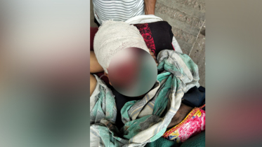 যশোরে মাথায় কোপ দিয়ে যুবককে হত্যার চেষ্টা