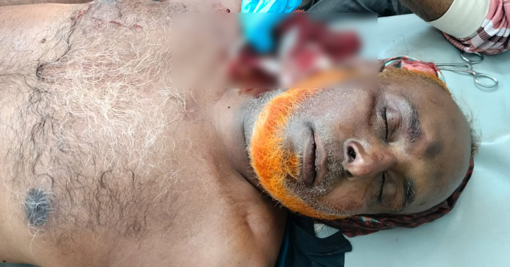 যশোরে রামদার আঘাতে একব্যক্তি জখম