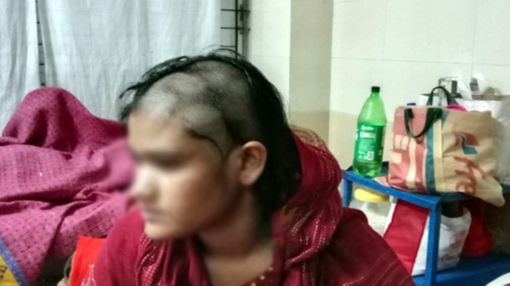 ঝিনাইদহে যৌতুক না পেয়ে দুই সন্তানের জননীর মাথার চুল কর্তন