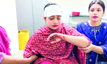 ইভটিজিংয়ের প্রতিবাদ করায় তরুণীর মাথায় ইট দিয়ে আঘাত